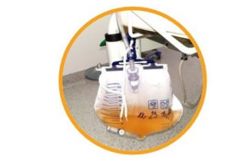 ¿Hasta qué punto son adecuadas las indicaciones del sondaje vesical en pacientes hospitalizados?